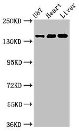 Western Blot. Positive WB detected in: U87 whole cell lysate, Rat heart tissue, Mouse liver tissue. All lanes: GRIN2A antibody at 3.2µg/ml. Secondary. Goat polyclonal to rabbit IgG at 1/50000 dilution. Predicted band size: 166, 145 kDa. Observed band size: 166 kDa