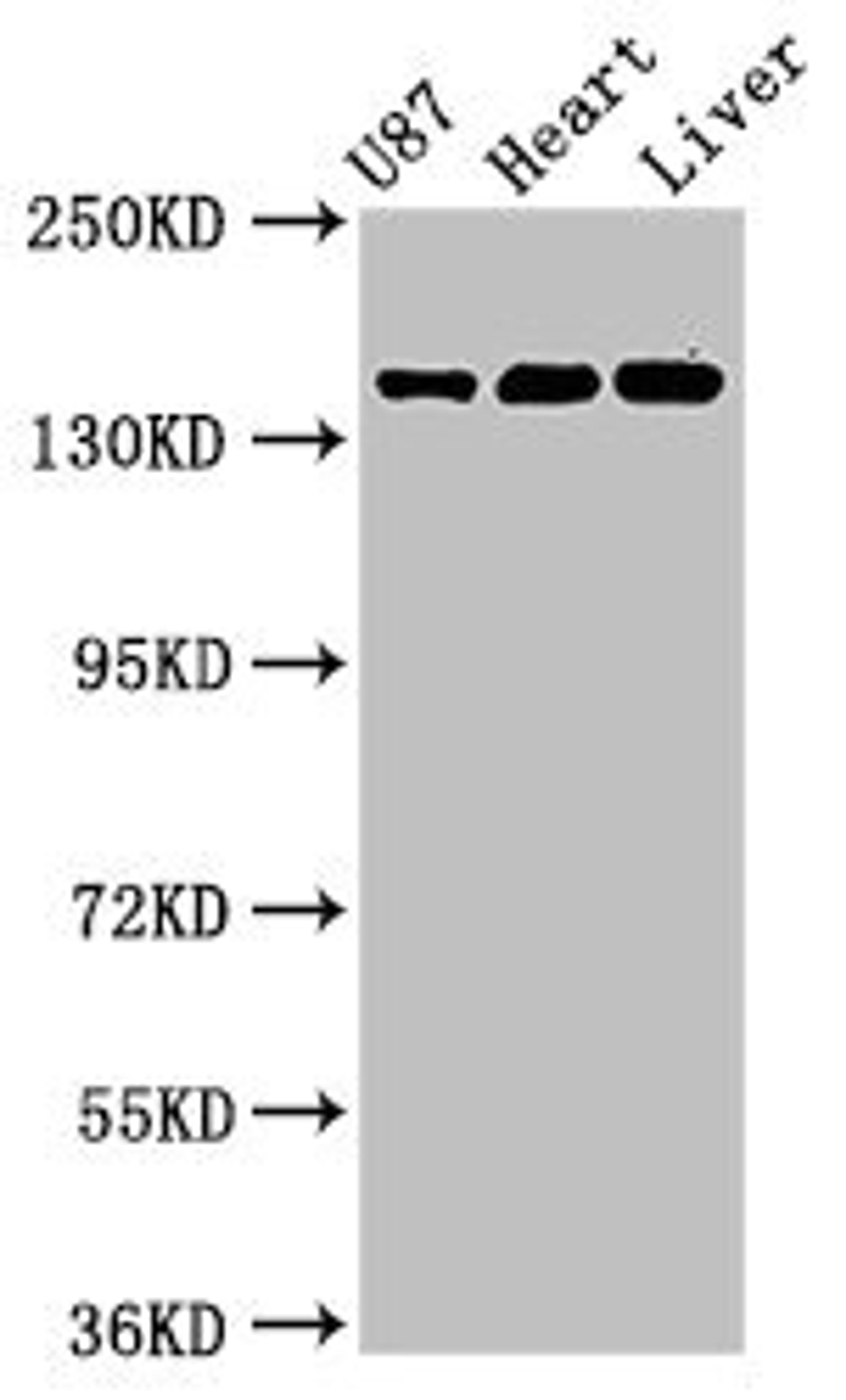 Western Blot. Positive WB detected in: U87 whole cell lysate, Rat heart tissue, Mouse liver tissue. All lanes: GRIN2A antibody at 3.2µg/ml. Secondary. Goat polyclonal to rabbit IgG at 1/50000 dilution. Predicted band size: 166, 145 kDa. Observed band size: 166 kDa