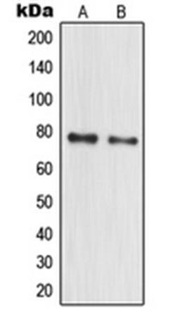 Western blot analysis of HeLa (Lane 1), MCF7 (Lane 2) whole cell lysates using MPHOSPH10 antibody