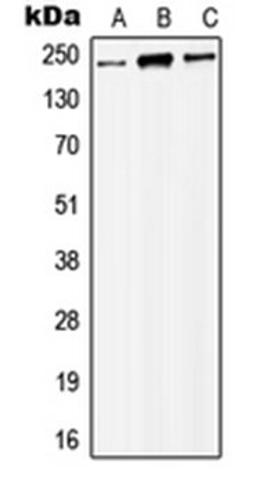 Western blot analysis of HEK293T (Lane 1), Raw264.7 (Lane 2), NIH3T3 (Lane 3) whole cell lysates using KAT6B antibody