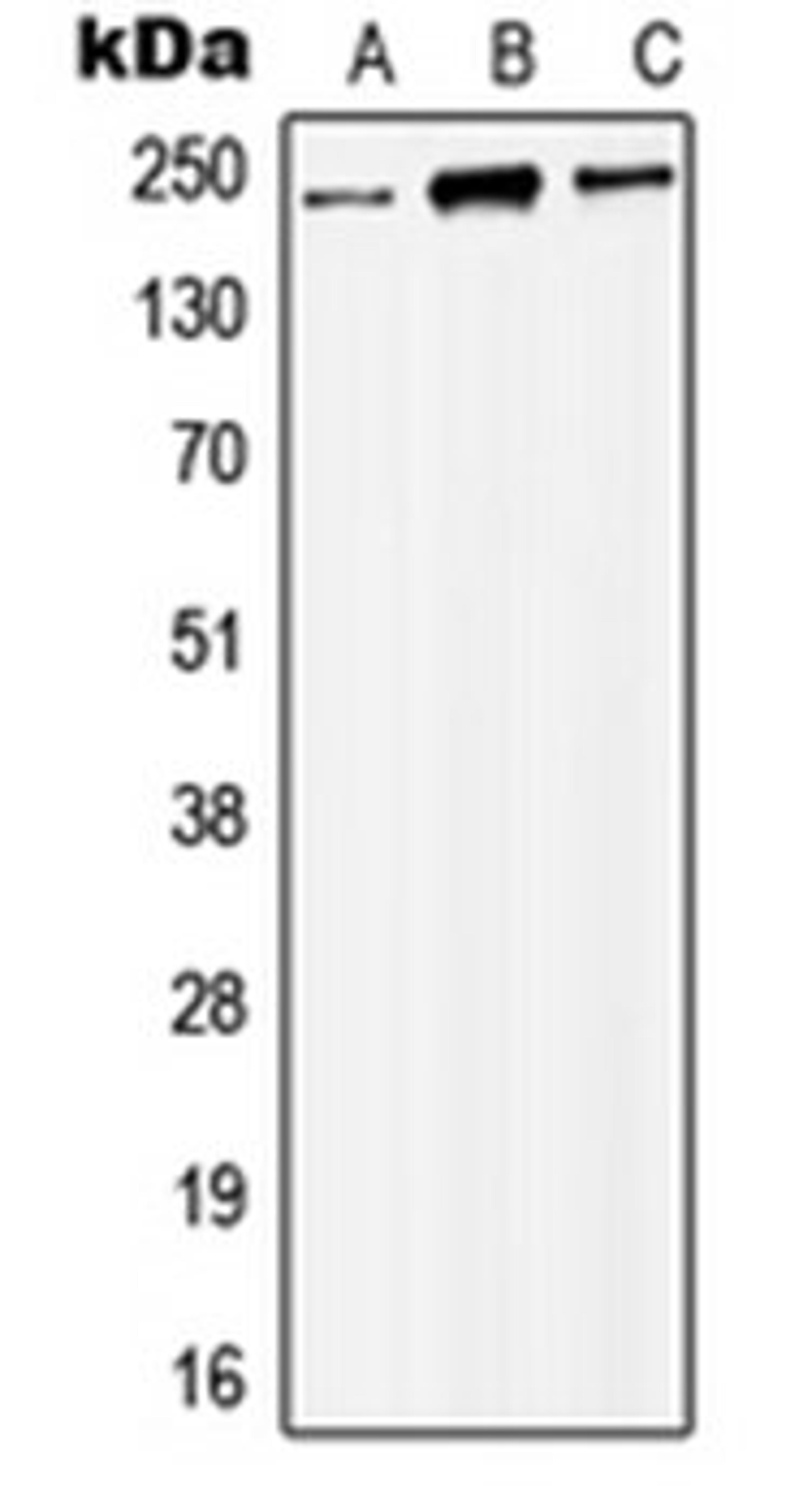 Western blot analysis of HEK293T (Lane 1), Raw264.7 (Lane 2), NIH3T3 (Lane 3) whole cell lysates using KAT6B antibody