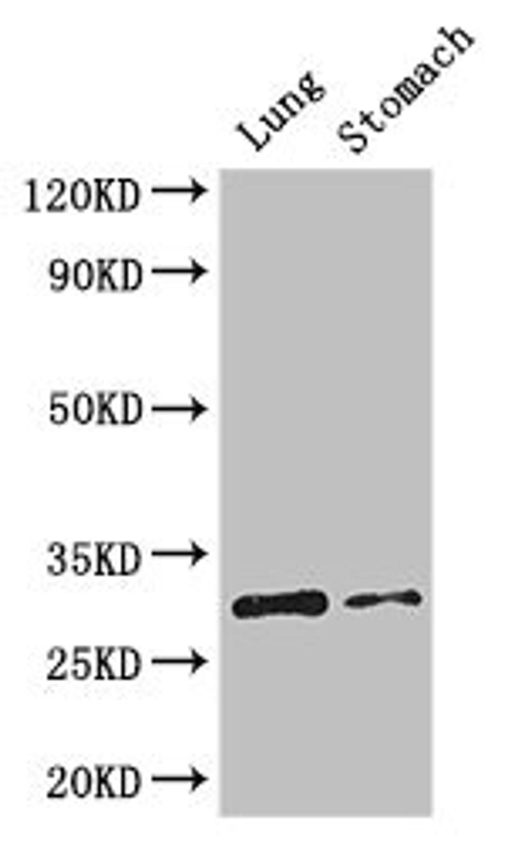 Western Blot. Positive WB detected in: Mouse lung tissue, Mouse stomach tissue. All lanes: TNFRSF5 antibody at 3.2ug/ml. Secondary. Goat polyclonal to rabbit IgG at 1/50000 dilution. Predicted band size: 31, 23 kDa. Observed band size: 31 kDa. 