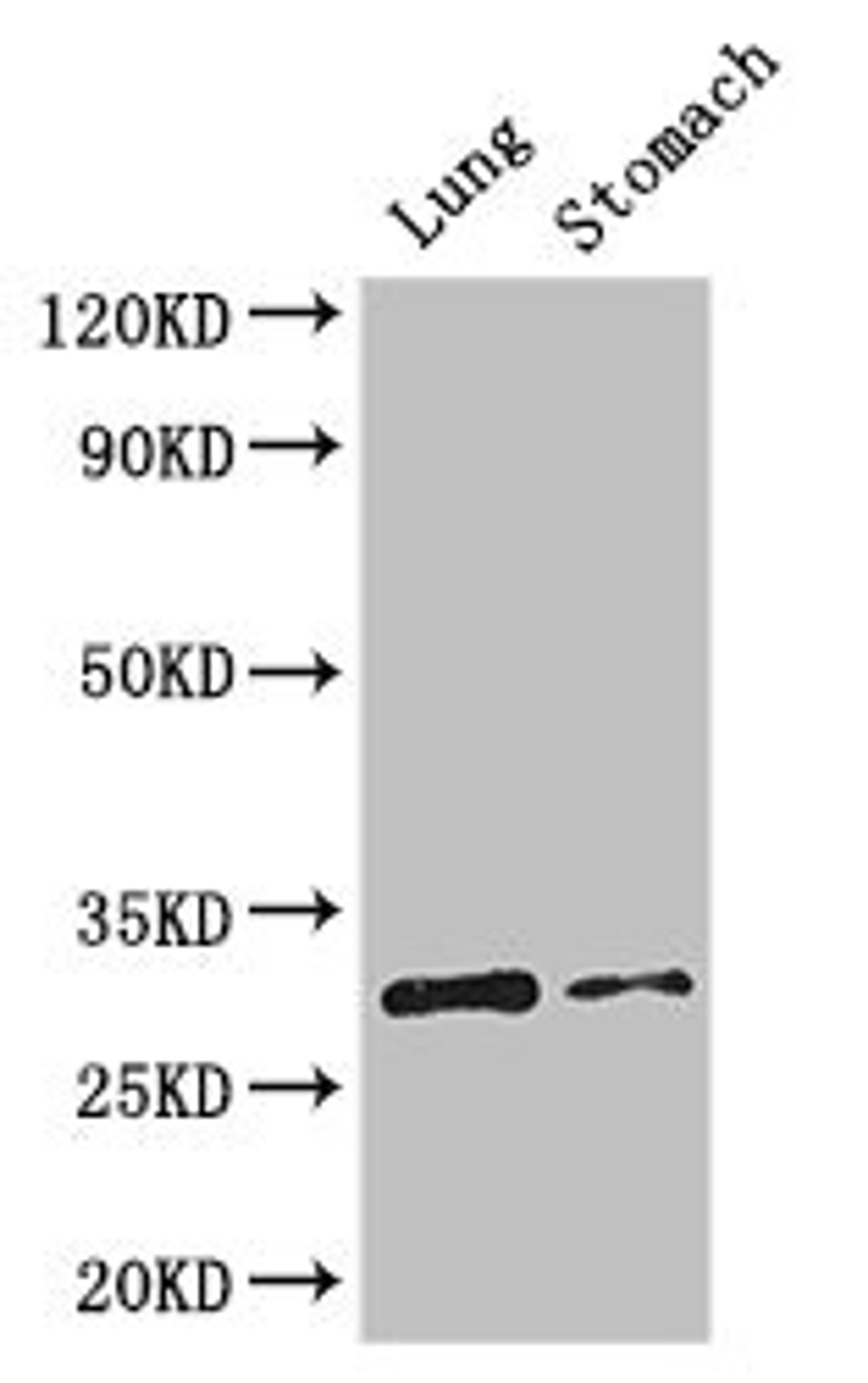 Western Blot. Positive WB detected in: Mouse lung tissue, Mouse stomach tissue. All lanes: TNFRSF5 antibody at 3.2ug/ml. Secondary. Goat polyclonal to rabbit IgG at 1/50000 dilution. Predicted band size: 31, 23 kDa. Observed band size: 31 kDa. 