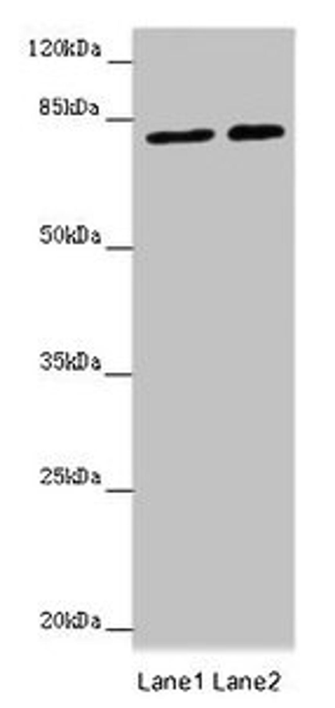 Western blot. All lanes: DHX33 antibody at 16µg/ml. Lane 1: Hela whole cell lysate. Lane 2: 293T whole cell lysate. Secondary. Goat polyclonal to rabbit IgG at 1/10000 dilution. Predicted band size: 79, 61 kDa. Observed band size: 79 kDa
