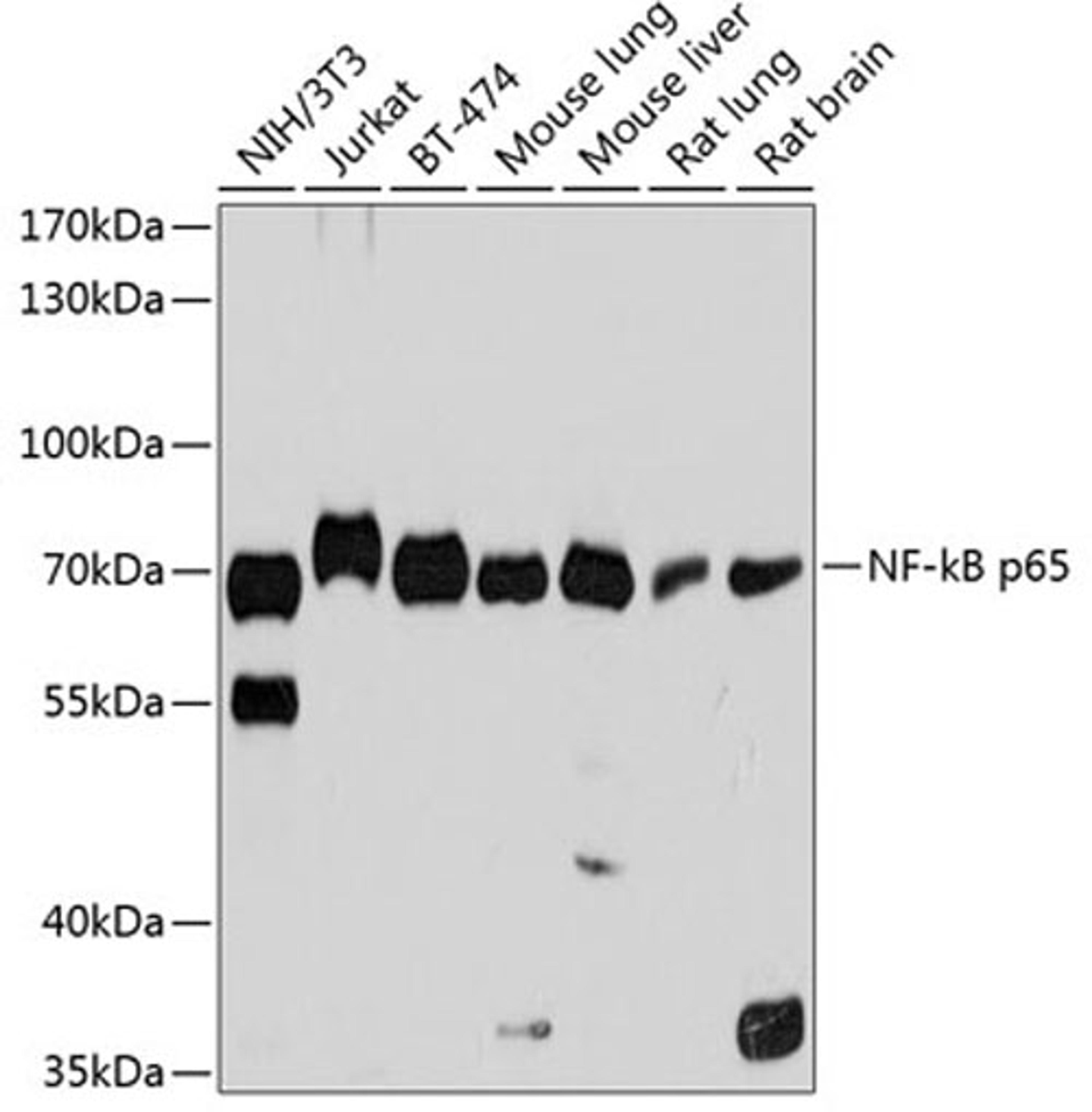 Western blot - NF-kB p65 antibody (A11204)