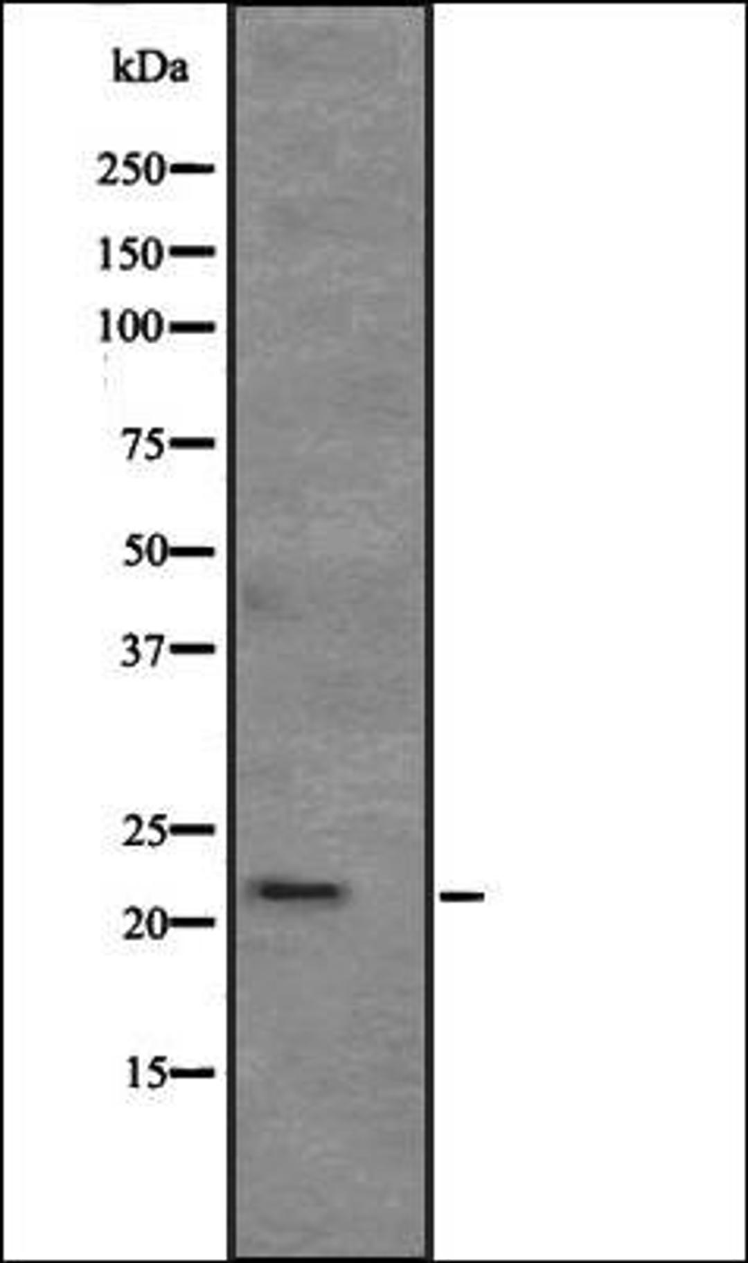 Western blot analysis of human kidney tissue lysate using APR3 antibody