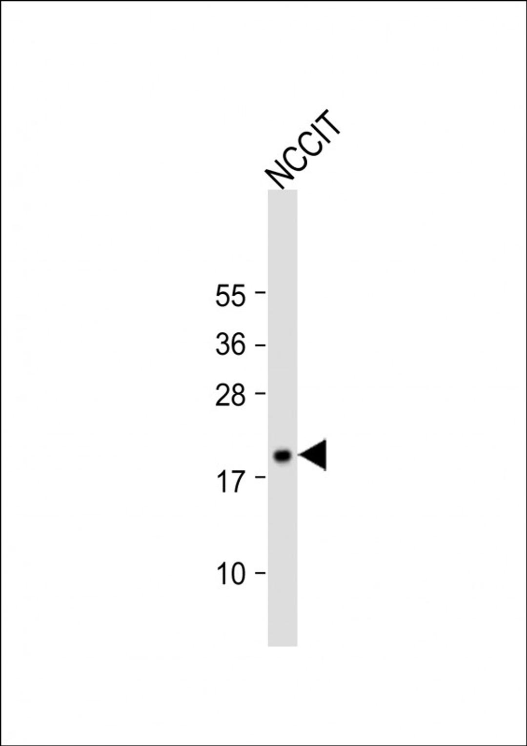 Western Blot at 1:1000 dilution + NCCIT whole cell lysate Lysates/proteins at 20 ug per lane.