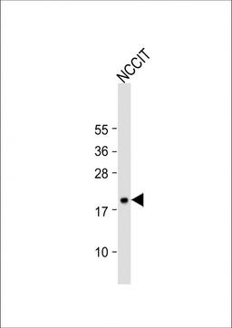 Western Blot at 1:1000 dilution + NCCIT whole cell lysate Lysates/proteins at 20 ug per lane.