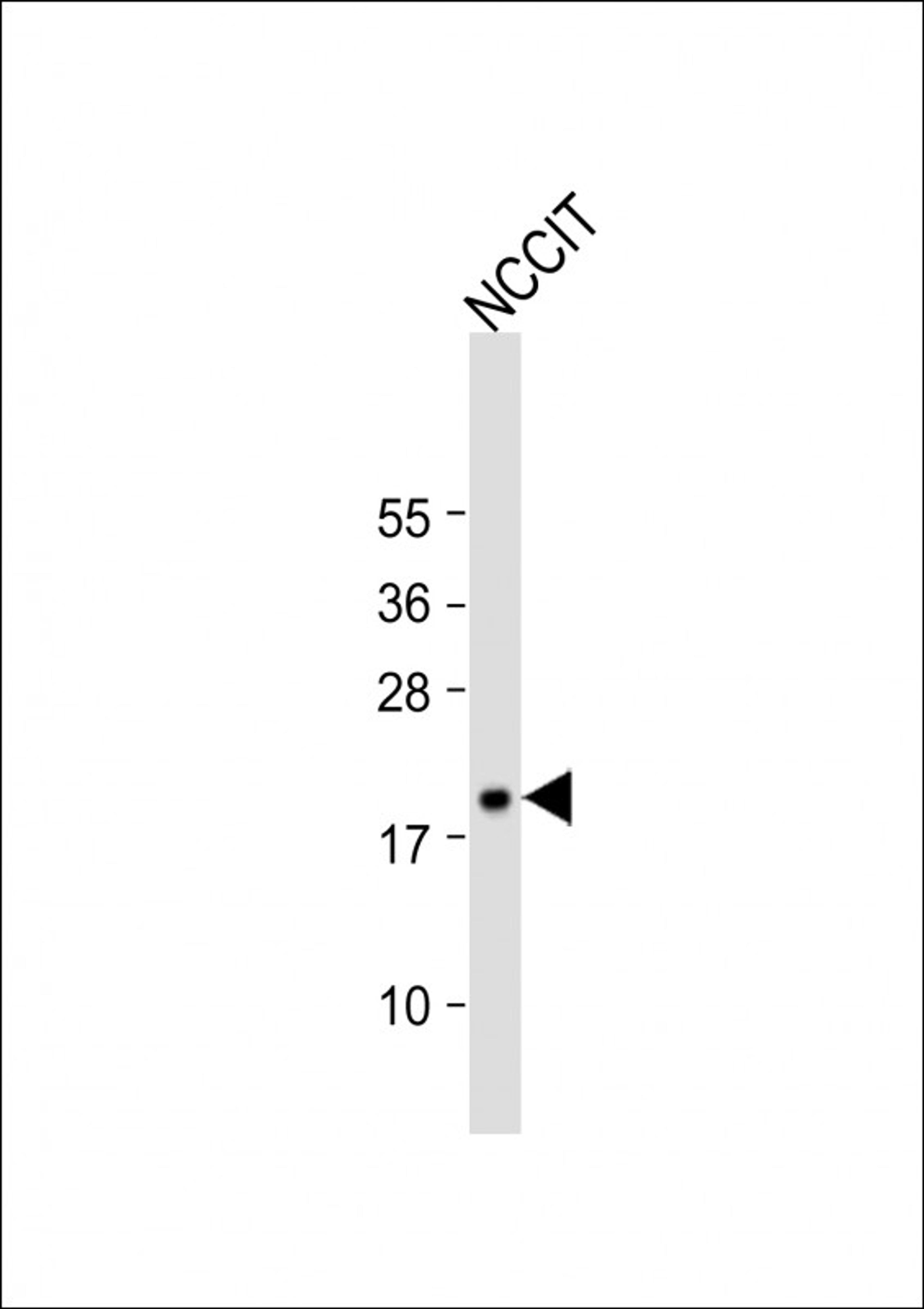 Western Blot at 1:1000 dilution + NCCIT whole cell lysate Lysates/proteins at 20 ug per lane.