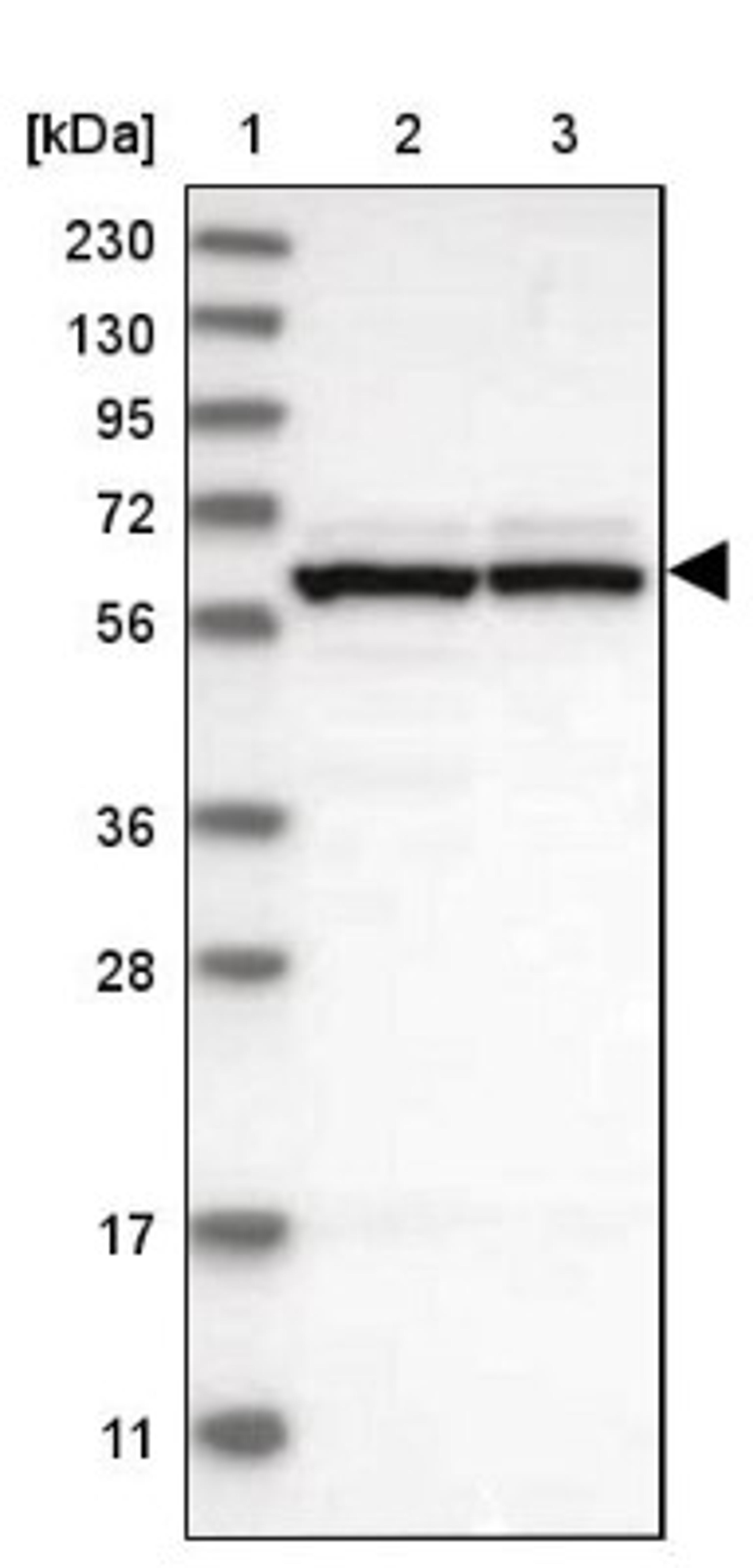 Western Blot: GTPBP2 Antibody [NBP1-85924] - Lane 1: Marker [kDa] 230, 130, 95, 72, 56, 36, 28, 17, 11<br/>Lane 2: Human cell line RT-4<br/>Lane 3: Human cell line U-251MG sp