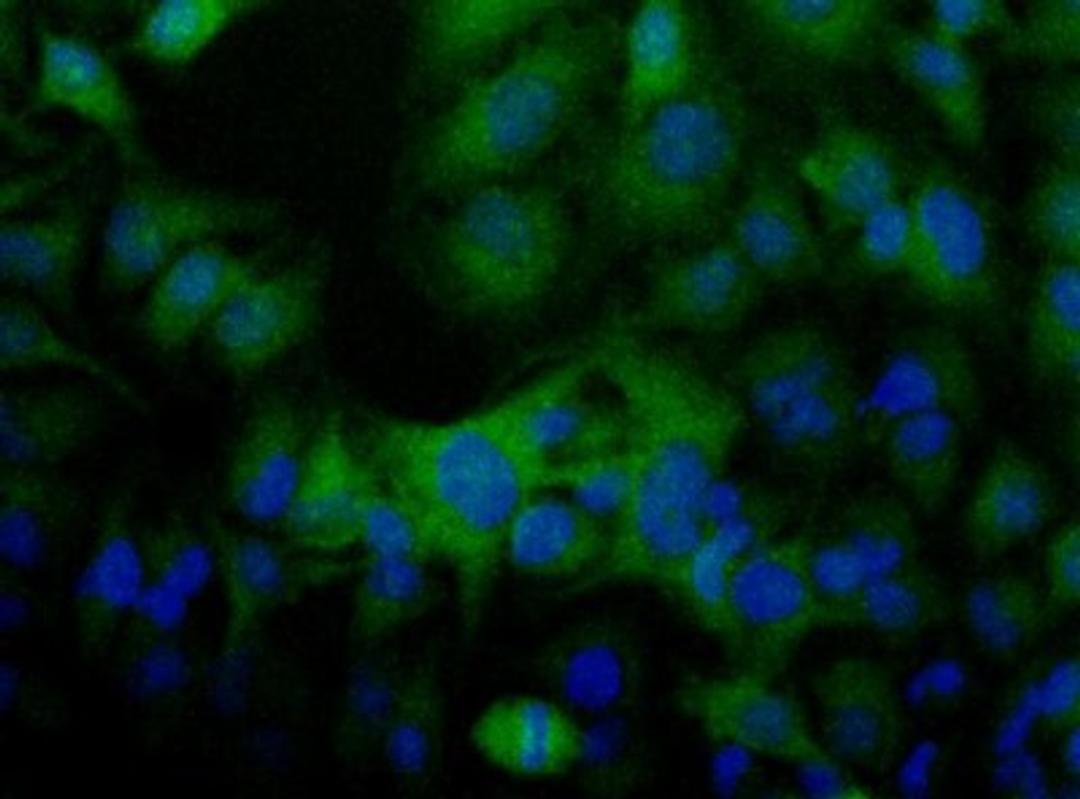 Immunocytochemistry/Immunofluorescence: Folliculin Antibody [NBP1-44995] - Detection of FLCN (Green) in Hela cells using NBP1-44995.  Nuclei (Blue) are counterstained using Hoechst 33258