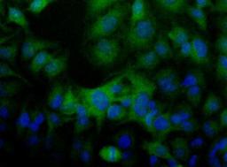 Immunocytochemistry/Immunofluorescence: Folliculin Antibody [NBP1-44995] - Detection of FLCN (Green) in Hela cells using NBP1-44995.  Nuclei (Blue) are counterstained using Hoechst 33258