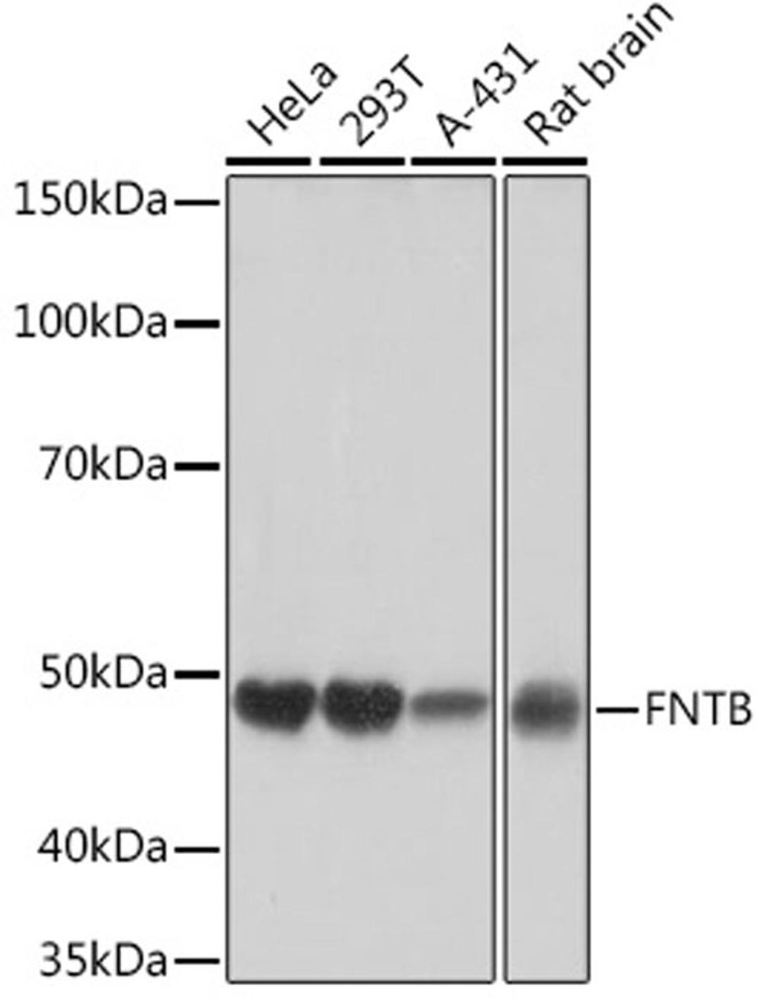 Western blot - FNTB Rabbit mAb (A2611)