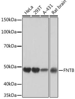 Western blot - FNTB Rabbit mAb (A2611)