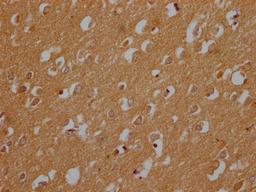 IHC image of CSB-PA822273LA01HU diluted at 1:200 and staining in paraffin-embedded human brain tissue performed on a Leica BondTM system. After dewaxing and hydration, antigen retrieval was mediated by high pressure in a citrate buffer (pH 6.0). Section was blocked with 10% normal goat serum 30min at RT. Then primary antibody (1% BSA) was incubated at 4°C overnight. The primary is detected by a Goat anti-rabbit polymer IgG labeled by HRP and visualized using 0.05% DAB.