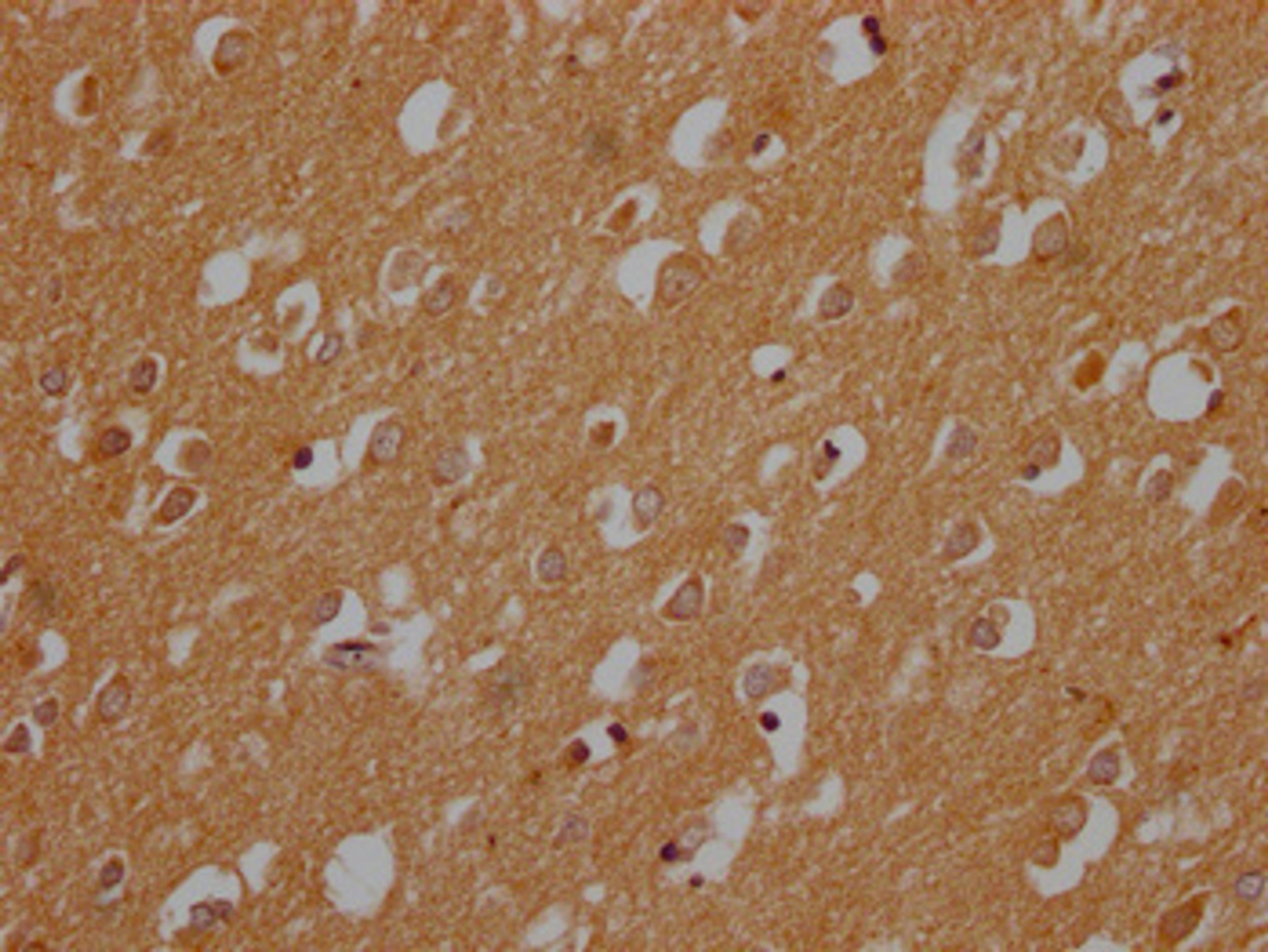 IHC image of CSB-PA822273LA01HU diluted at 1:200 and staining in paraffin-embedded human brain tissue performed on a Leica BondTM system. After dewaxing and hydration, antigen retrieval was mediated by high pressure in a citrate buffer (pH 6.0). Section was blocked with 10% normal goat serum 30min at RT. Then primary antibody (1% BSA) was incubated at 4°C overnight. The primary is detected by a Goat anti-rabbit polymer IgG labeled by HRP and visualized using 0.05% DAB.