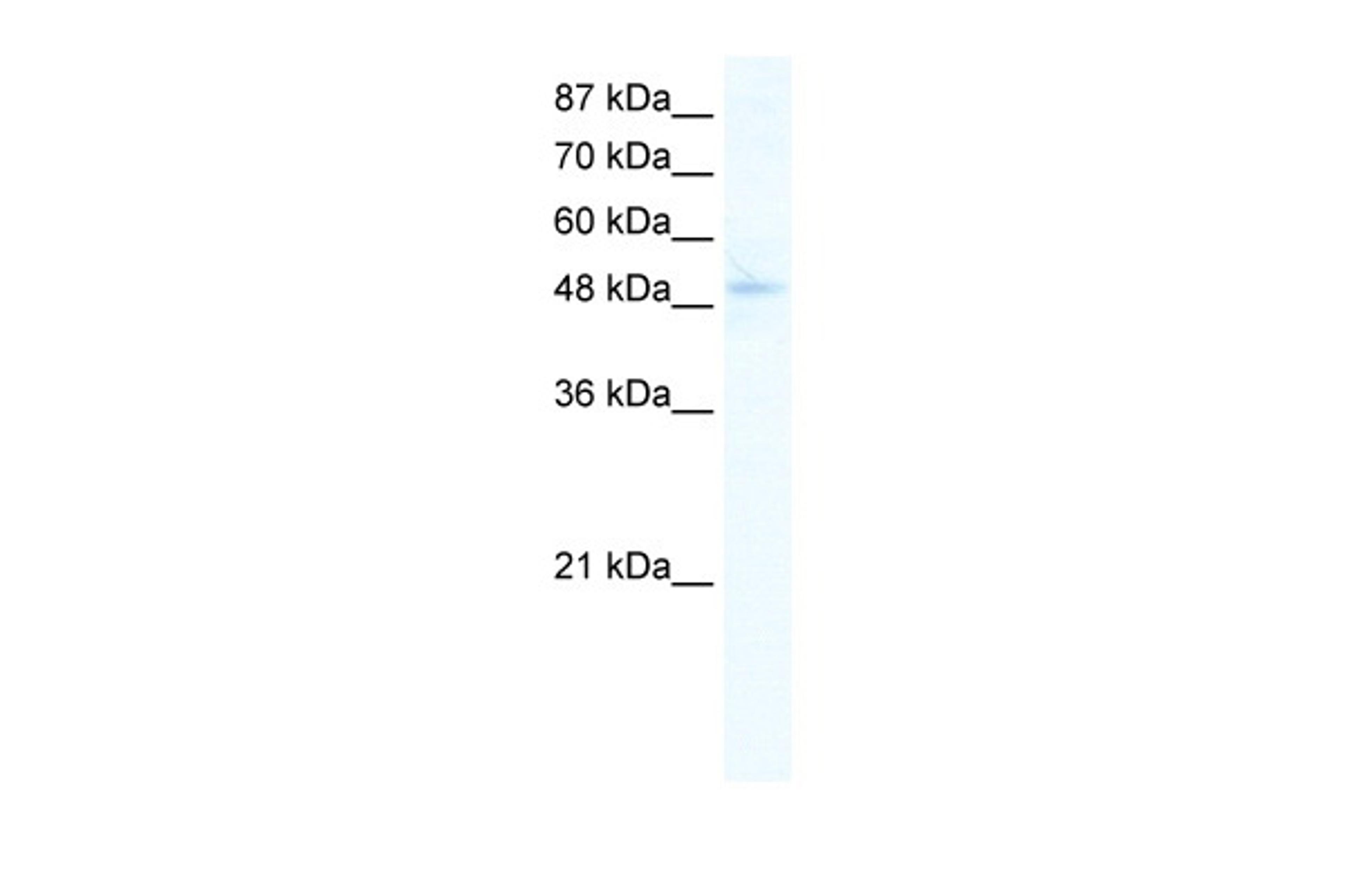 Antibody used in WB on Human Jurkat 0.2-1 ug/ml.