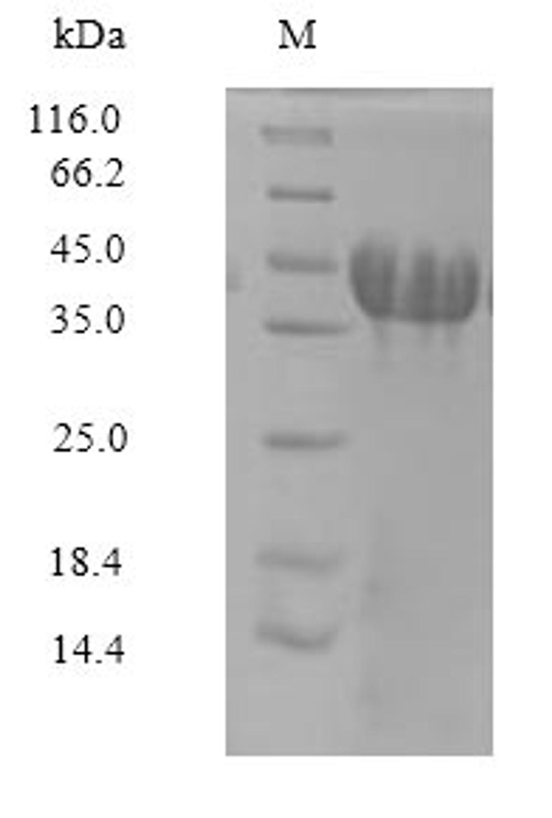 (Tris-Glycine gel) Discontinuous SDS-PAGE (reduced) with 5% enrichment gel and 15% separation gel.