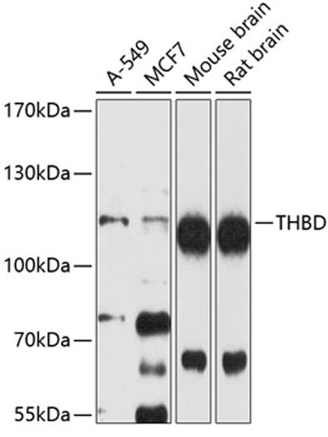 Western blot - THBD antibody (A4155)