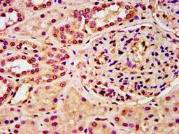 IHC image of CSB-PA010418OA28nphHU diluted at 1:10 and staining in paraffin-embedded human kidney tissue performed on a Leica BondTM system. After dewaxing and hydration, antigen retrieval was mediated by high pressure in a citrate buffer (pH 6.0). Section was blocked with 10% normal goat serum 30min at RT. Then primary antibody (1% BSA) was incubated at 4&deg;C overnight. The primary is detected by a biotinylated secondary antibody and visualized using an HRP conjugated SP system.