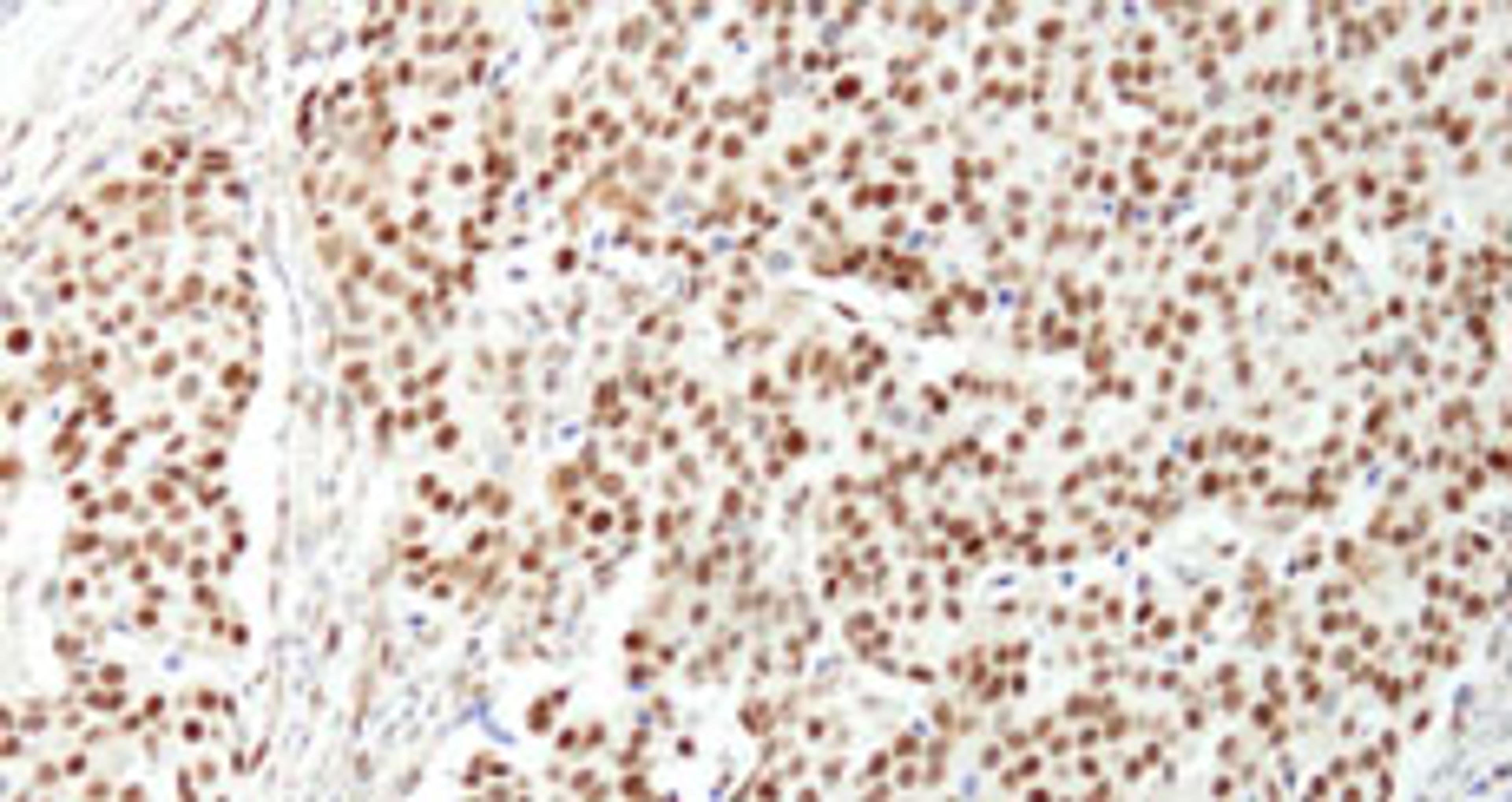 Detection of human NUCKS by immunohistochemistry.