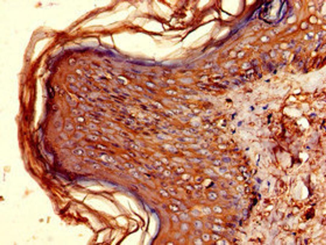 Immunohistochemistry of paraffin-embedded human skin tissue using CSB-PA14849A0Rb at dilution of 1:100
