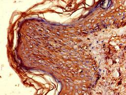 Immunohistochemistry of paraffin-embedded human skin tissue using CSB-PA14849A0Rb at dilution of 1:100