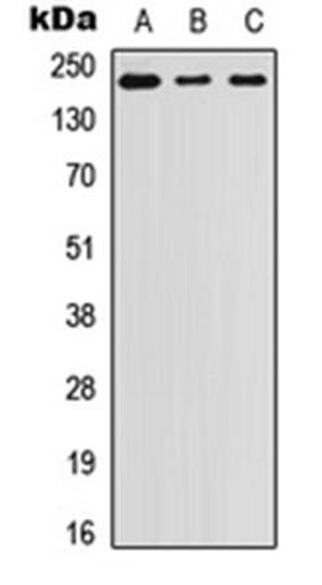 Western blot analysis of A431 (Lane1), SW480 (Lane2), PC3 (Lane3) whole cell using Laminin beta 1 antibody