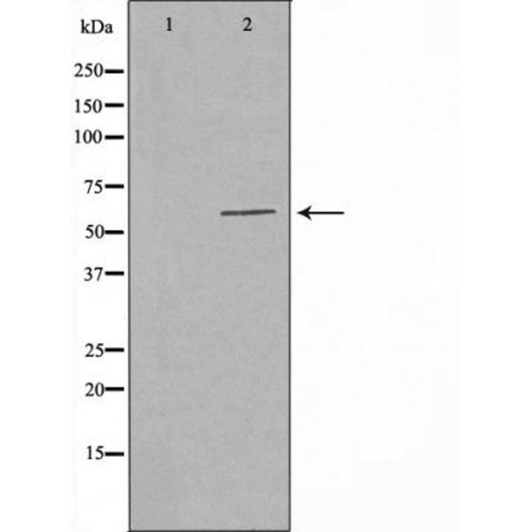 Western blot analysis of K562 cells CoLo205 cells and HuvEc cells using RPC3 antibody