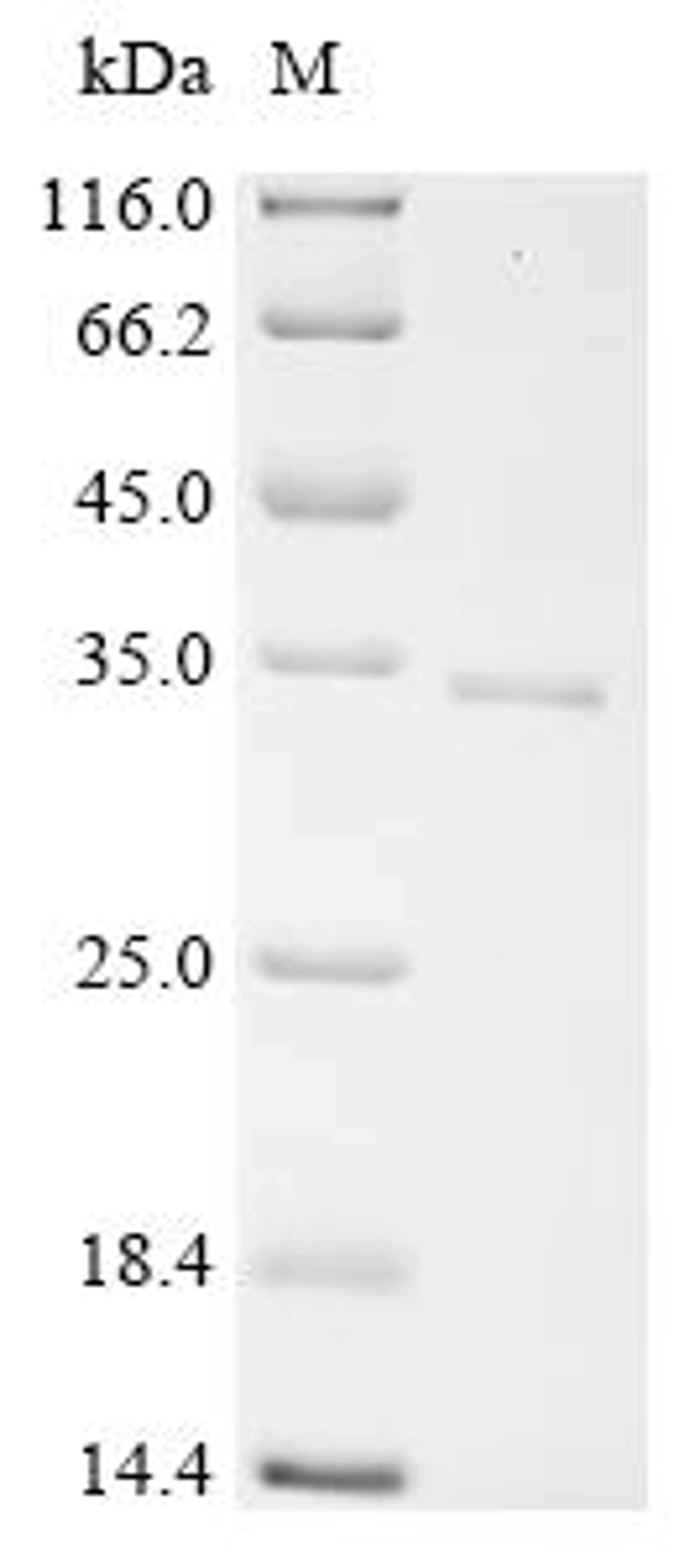 (Tris-Glycine gel) Discontinuous SDS-PAGE (reduced) with 5% enrichment gel and 15% separation gel.