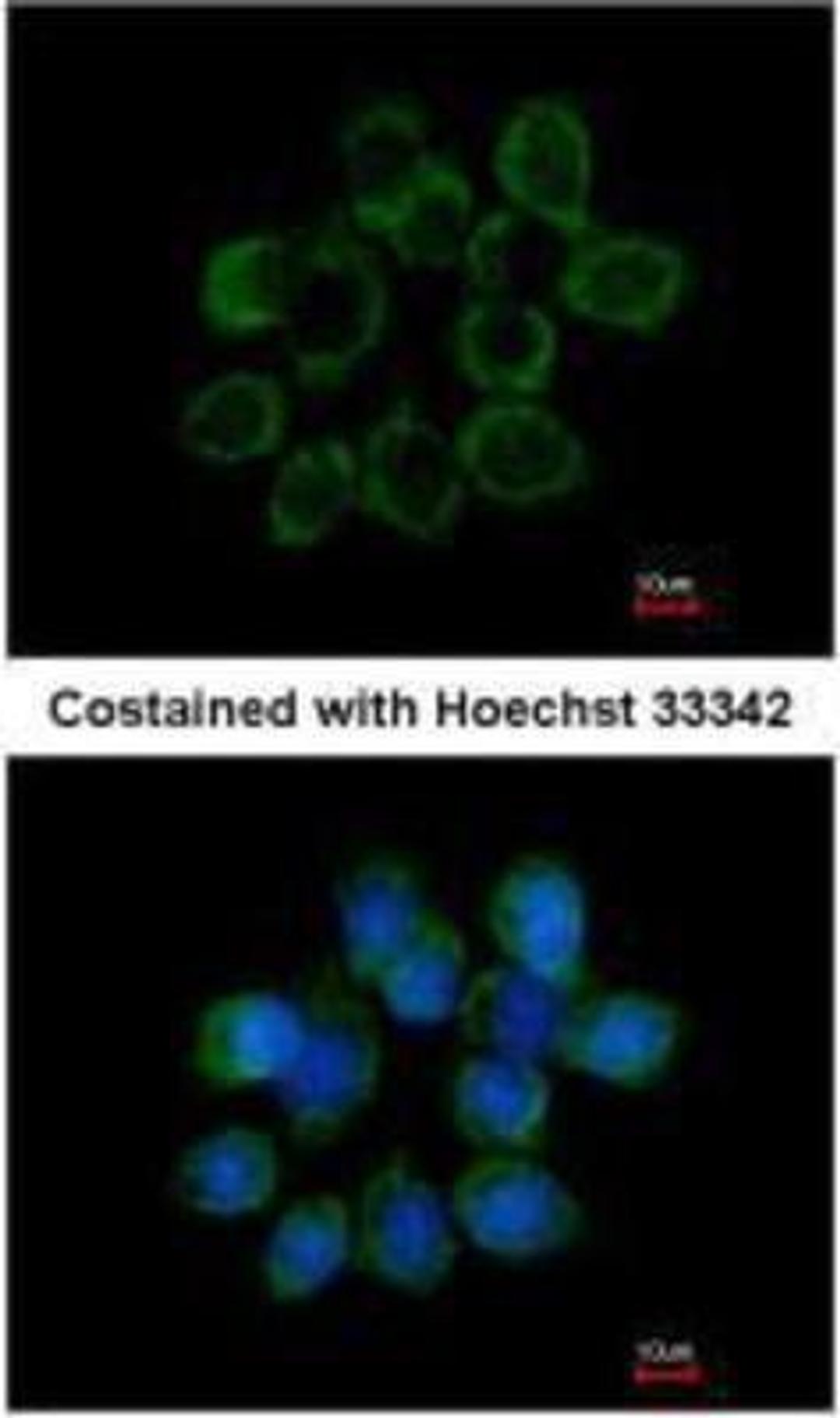 Immunocytochemistry/Immunofluorescence: WISP-1/CCN4 Antibody [NBP1-31230] - Methanol-fixed A431, using WISP1 antibody at 1:200 dilution.