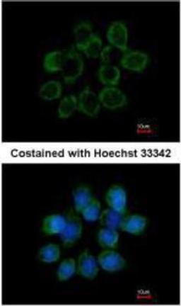 Immunocytochemistry/Immunofluorescence: WISP-1/CCN4 Antibody [NBP1-31230] - Methanol-fixed A431, using WISP1 antibody at 1:200 dilution.