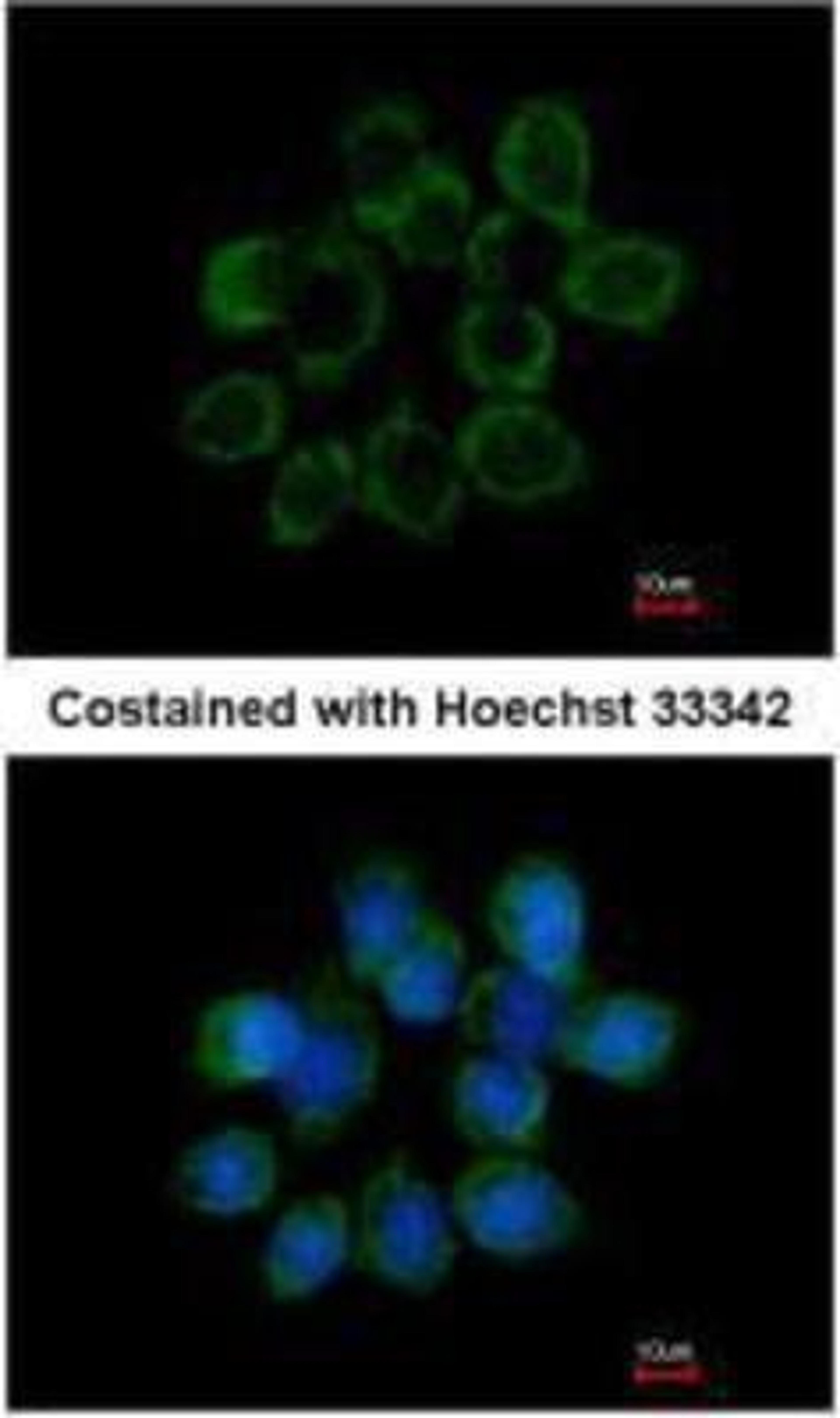 Immunocytochemistry/Immunofluorescence: WISP-1/CCN4 Antibody [NBP1-31230] - Methanol-fixed A431, using WISP1 antibody at 1:200 dilution.