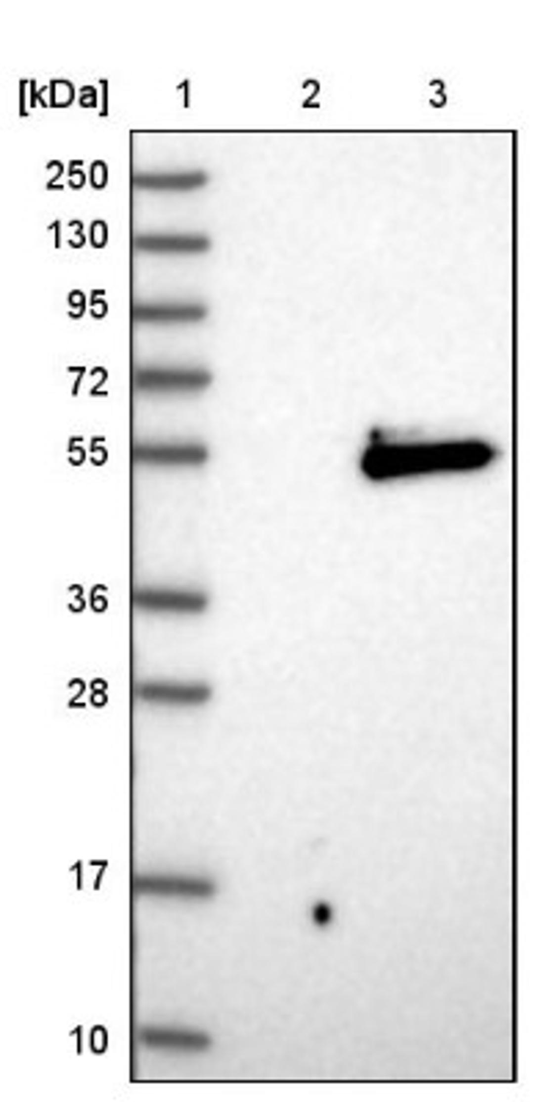 Western Blot: Cyclin G2 Antibody [NBP1-87518] - Lane 1: Marker [kDa] 250, 130, 95, 72, 55, 36, 28, 17, 10<br/>Lane 2: Negative control (vector only transfected HEK293T lysate)<br/>Lane 3: Over-expression lysate (Co-expressed with a C-terminal myc-DDK tag (~3.1 kDa) in mammalian HEK293T cells, LY401388)