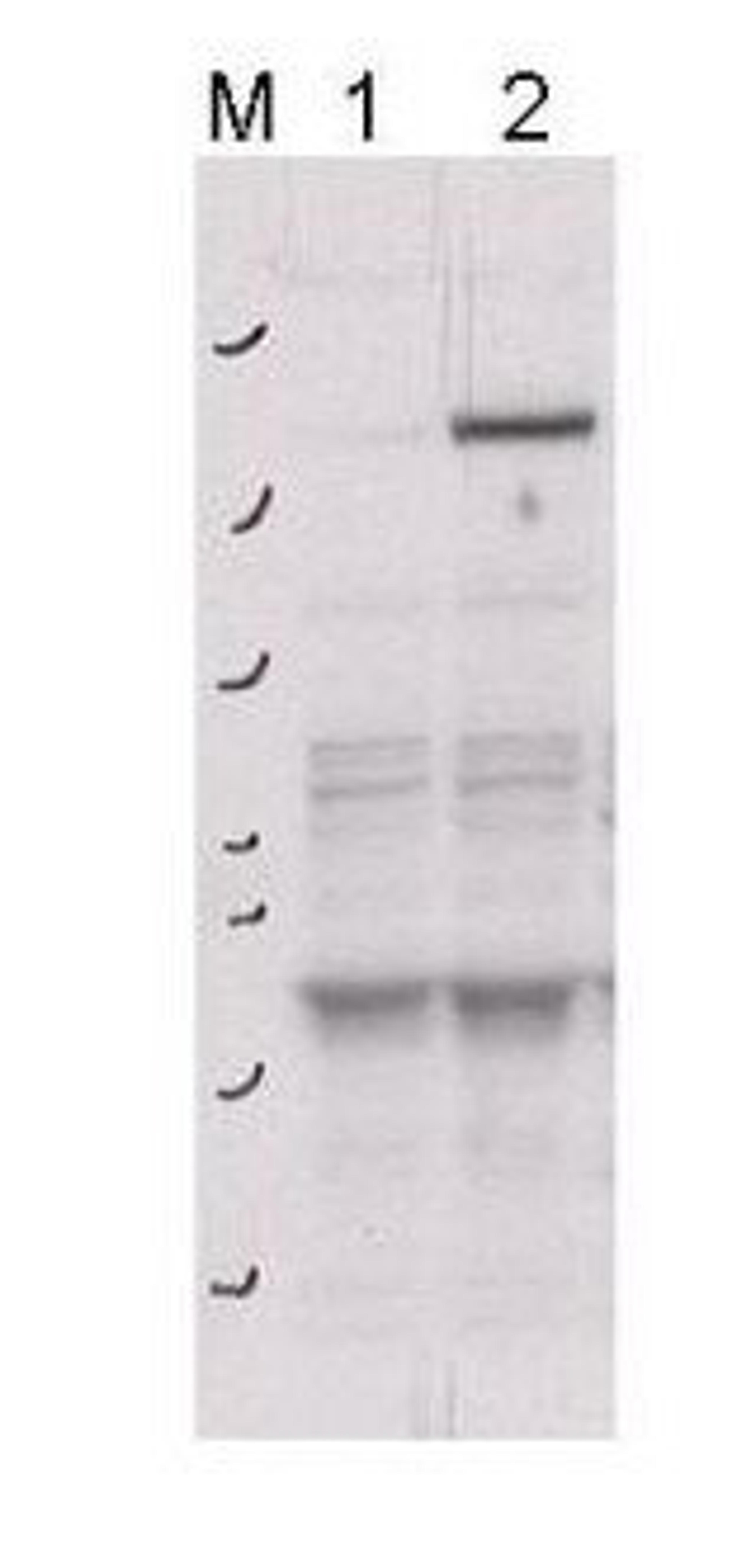 Western blot analysis of 293T cells using Rock-2 (phospho-Y256) antibody