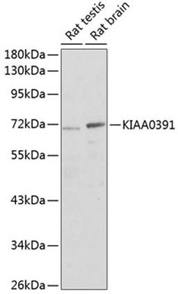 Western blot - KIAA0391 antibody (A3360)