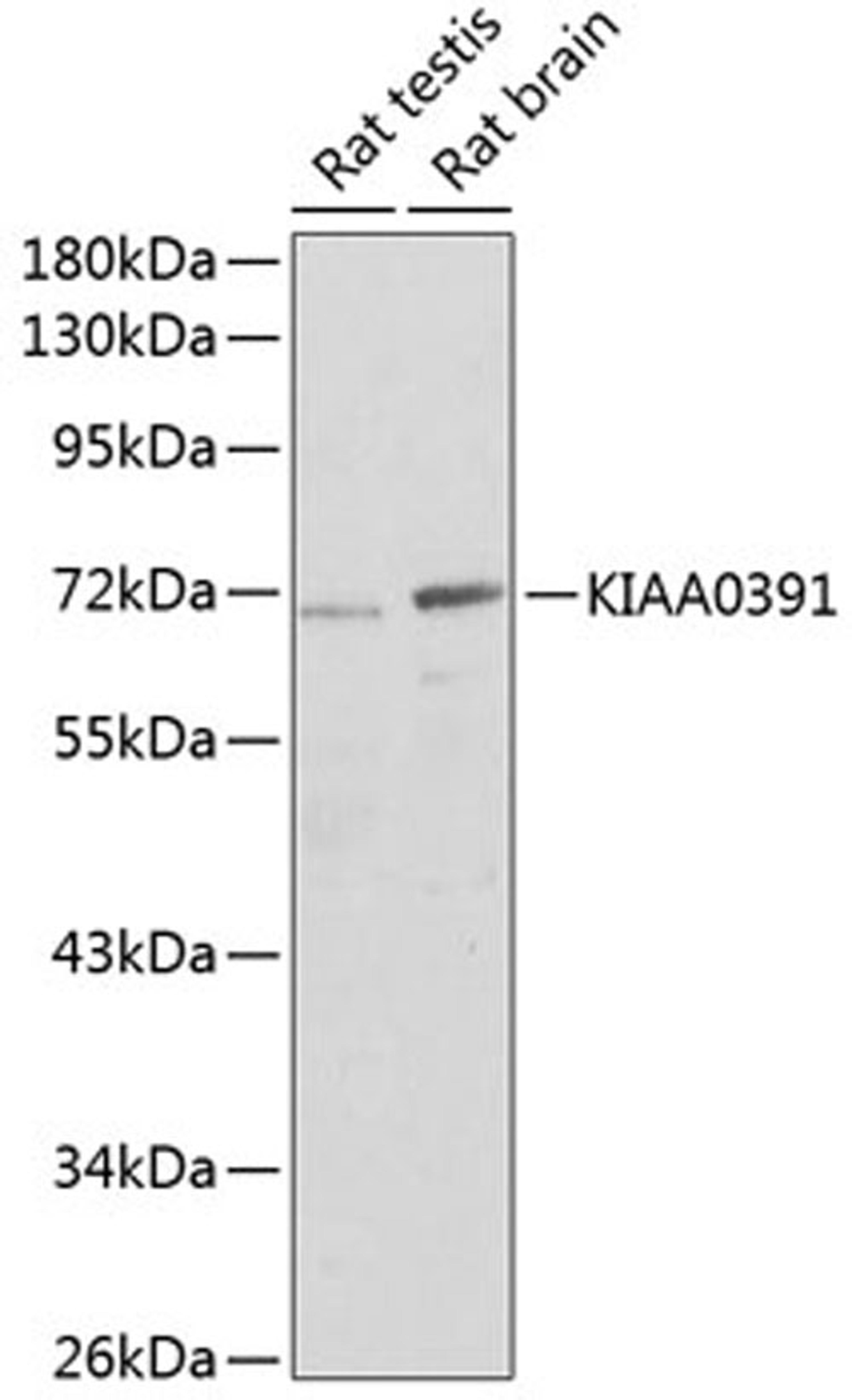 Western blot - KIAA0391 antibody (A3360)