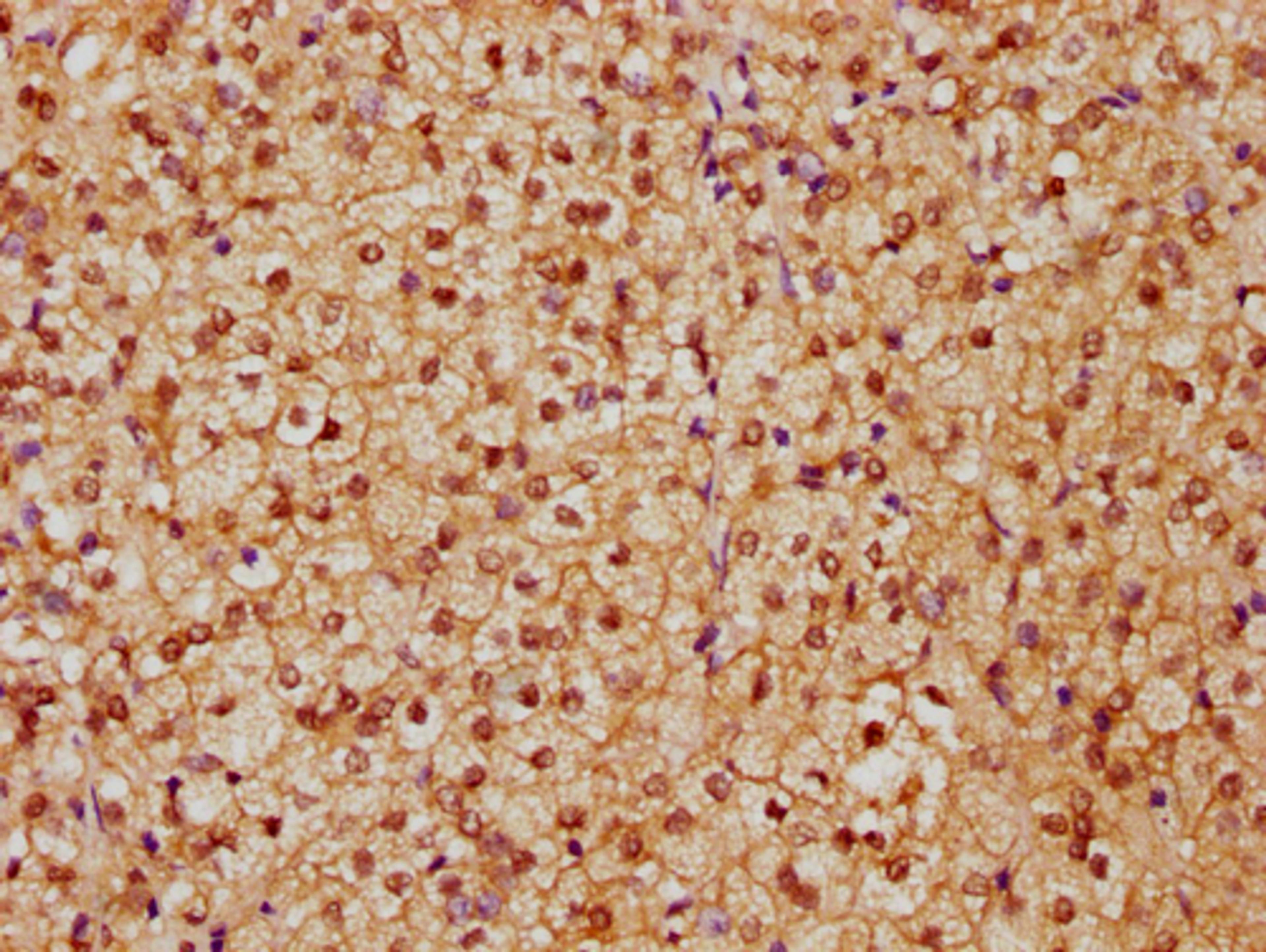 IHC image of CSB-PA010429PA91nhibHU diluted at 1:20 and staining in paraffin-embedded human adrenal gland tissue performed on a Leica BondTM system. After dewaxing and hydration, antigen retrieval was mediated by high pressure in a citrate buffer (pH 6.0). Section was blocked with 10% normal goat serum 30min at RT. Then primary antibody (1% BSA) was incubated at 4°C overnight. The primary is detected by a biotinylated secondary antibody and visualized using an HRP conjugated SP system.