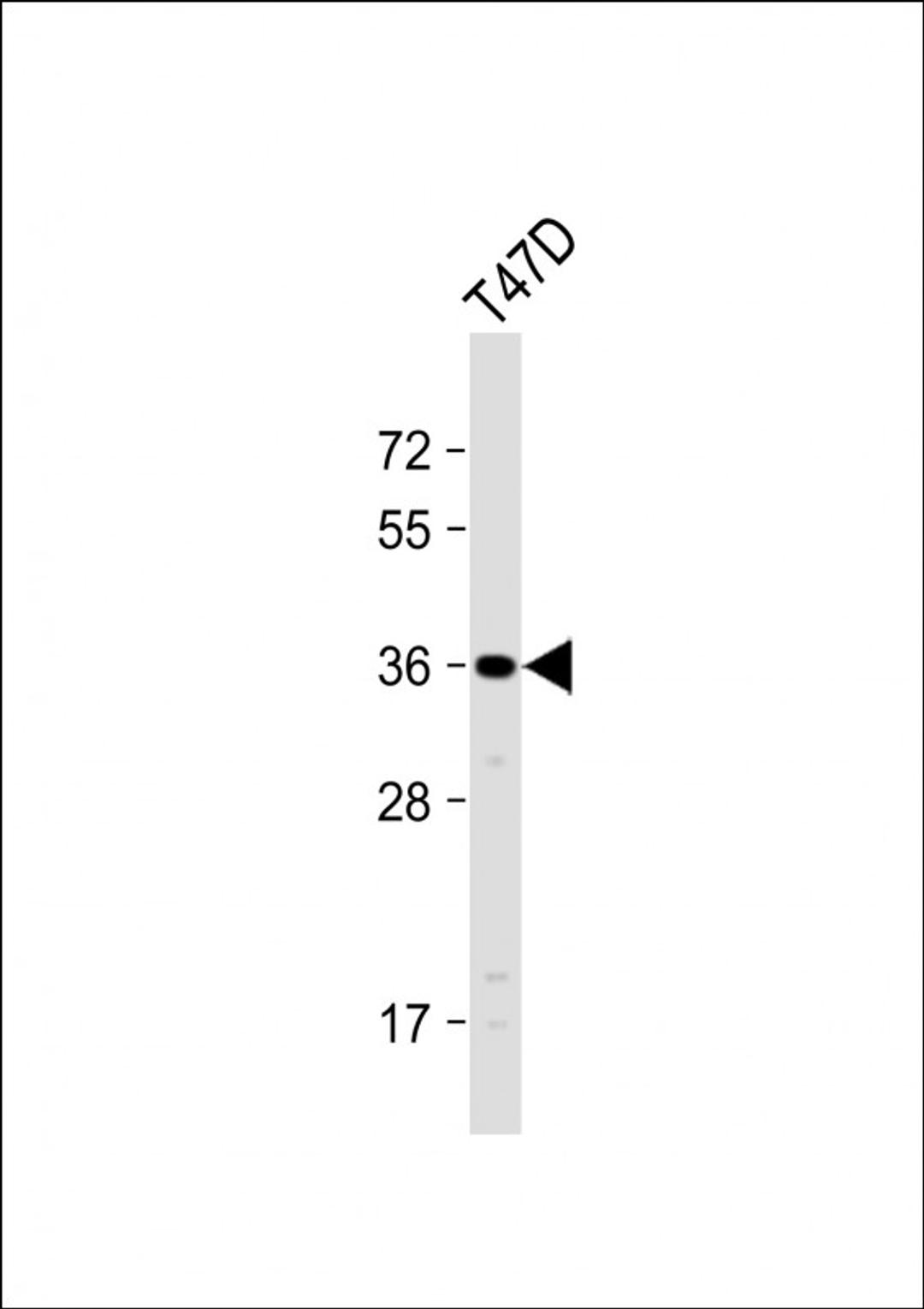 Western Blot at 1:1000 dilution + T47D whole cell lysate Lysates/proteins at 20 ug per lane.