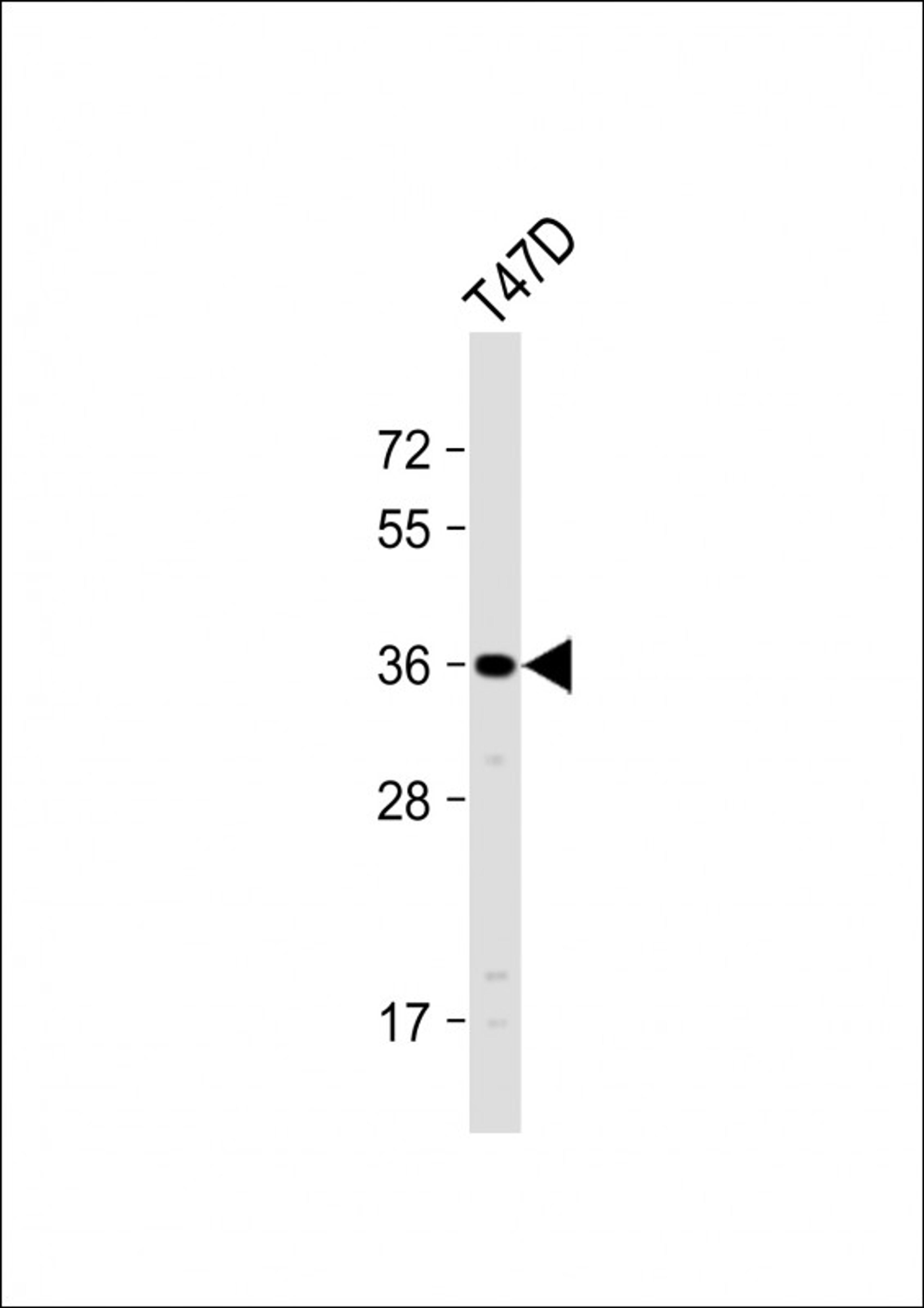 Western Blot at 1:1000 dilution + T47D whole cell lysate Lysates/proteins at 20 ug per lane.