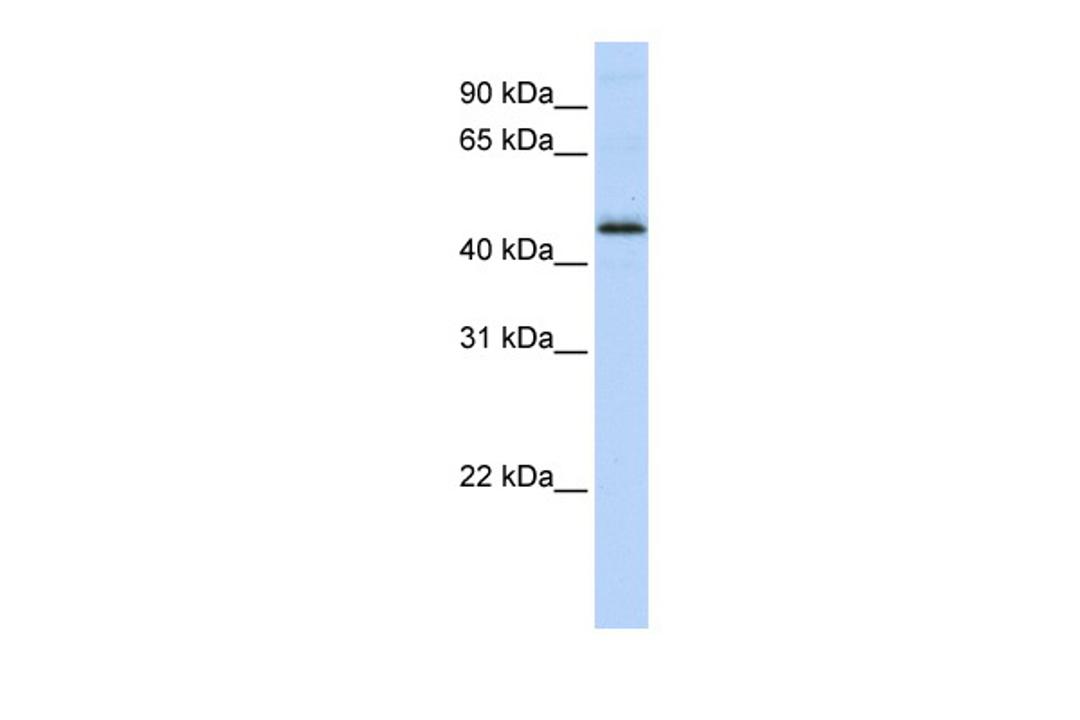 Antibody used in WB on Human MCF-7 at 0.2-1 ug/ml.