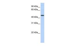 Antibody used in WB on Human MCF-7 at 0.2-1 ug/ml.