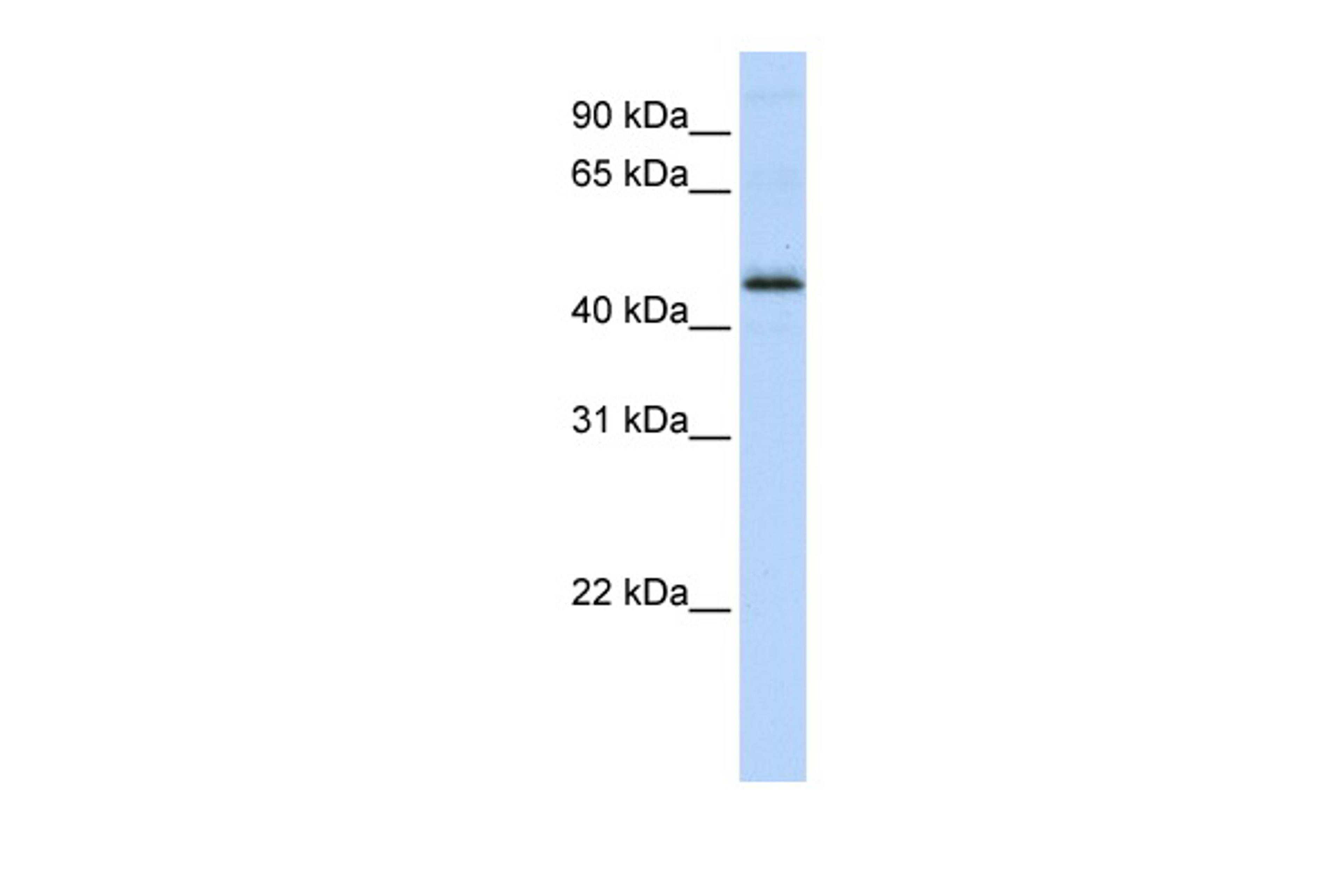 Antibody used in WB on Human MCF-7 at 0.2-1 ug/ml.