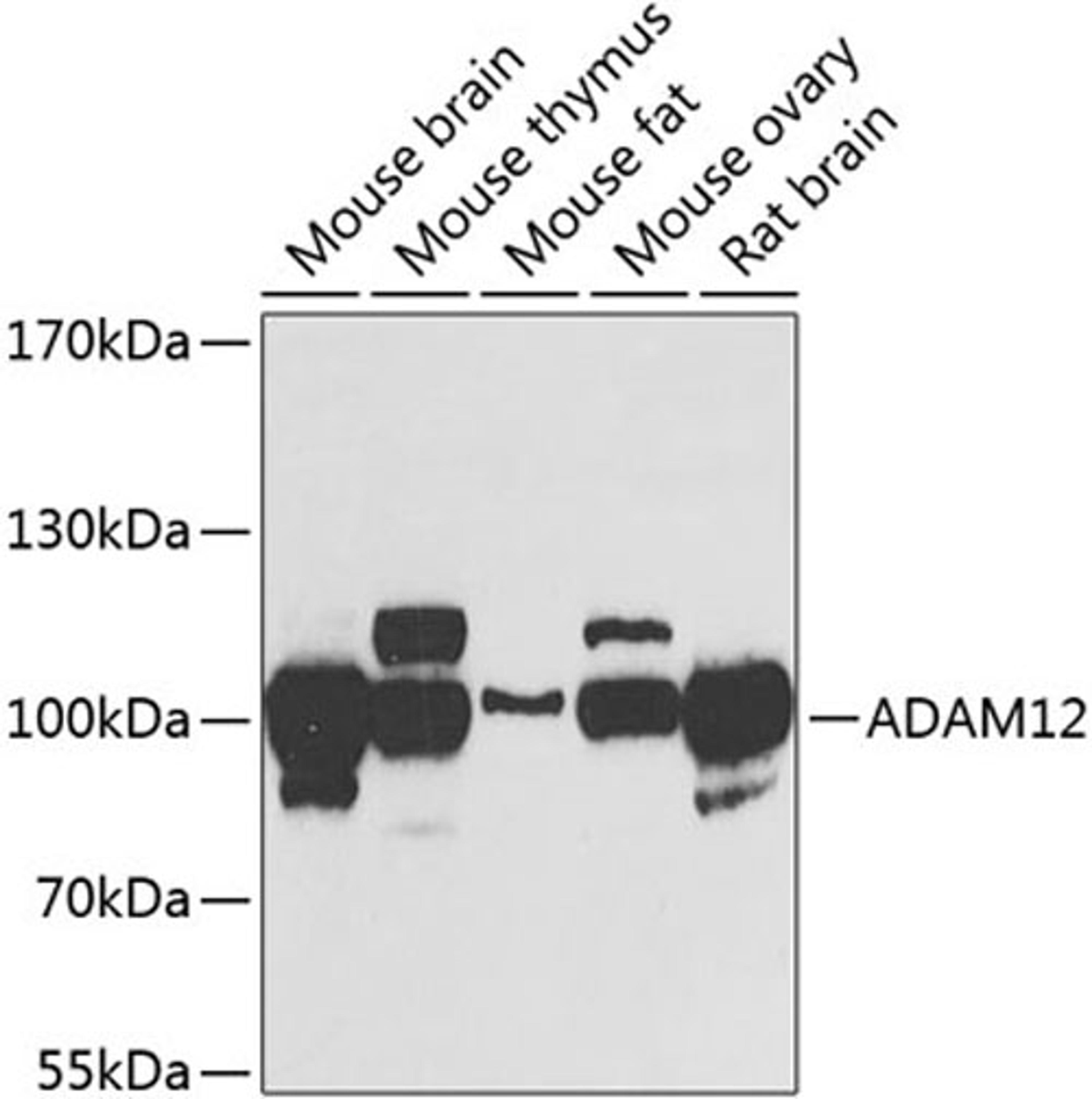 Western blot - ADAM12 antibody (A7940)