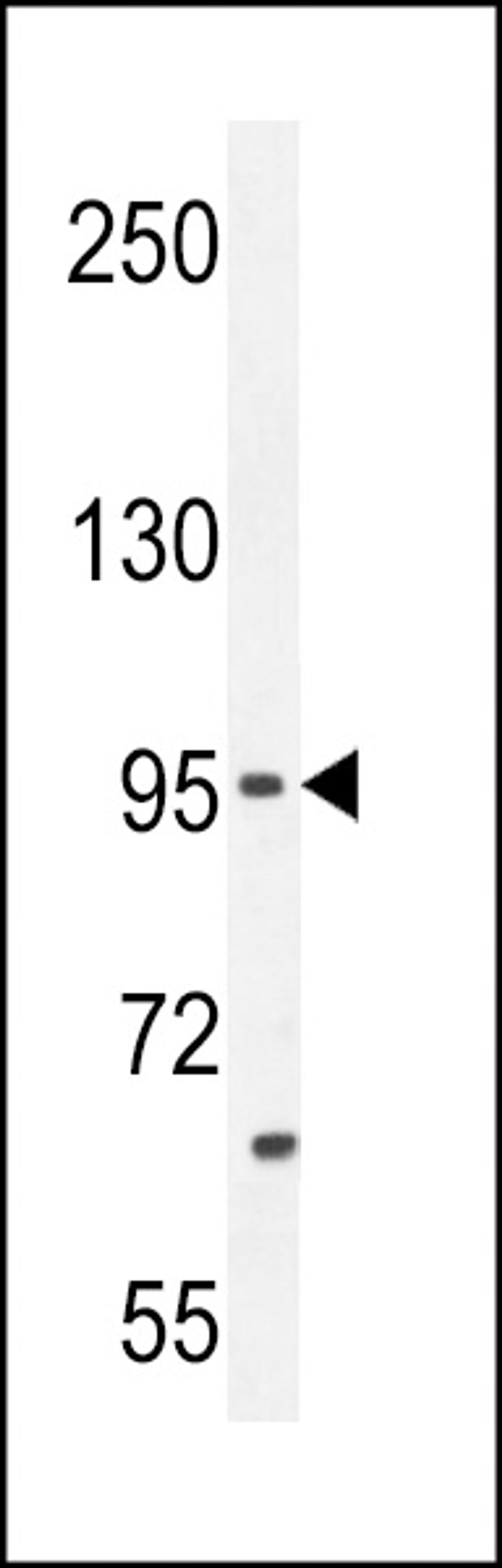 Western blot analysis in MCF-7 cell line lysates (35ug/lane).