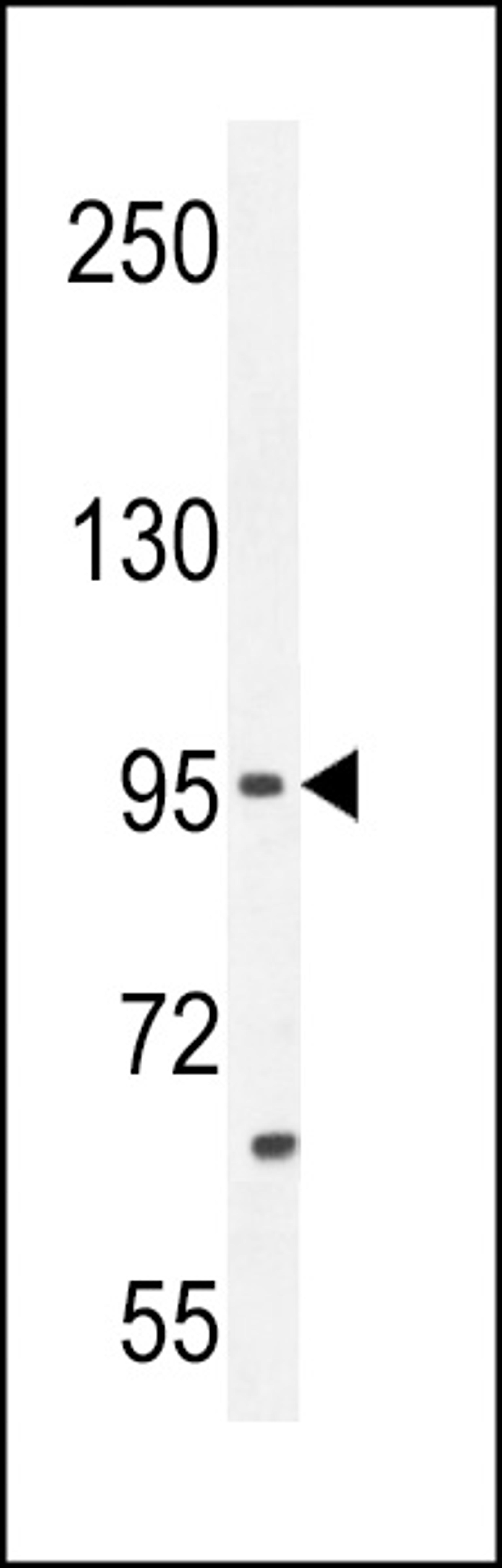 Western blot analysis in MCF-7 cell line lysates (35ug/lane).