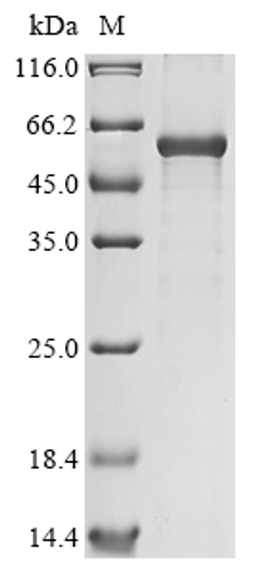 (Tris-Glycine gel) Discontinuous SDS-PAGE (reduced) with 5% enrichment gel and 15% separation gel.