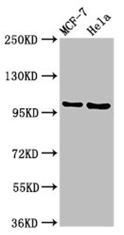 Western Blot. Positive WB detected in: MCF-7 whole cell lysate, Hela whole cell lysate. All lanes: NUP98 antibody at 3.2ug/ml. Secondary. Goat polyclonal to rabbit IgG at 1/50000 dilution. Predicted band size: 198, 188, 98, 97, 196, 187 kDa. Observed band size: 105 kDa. 