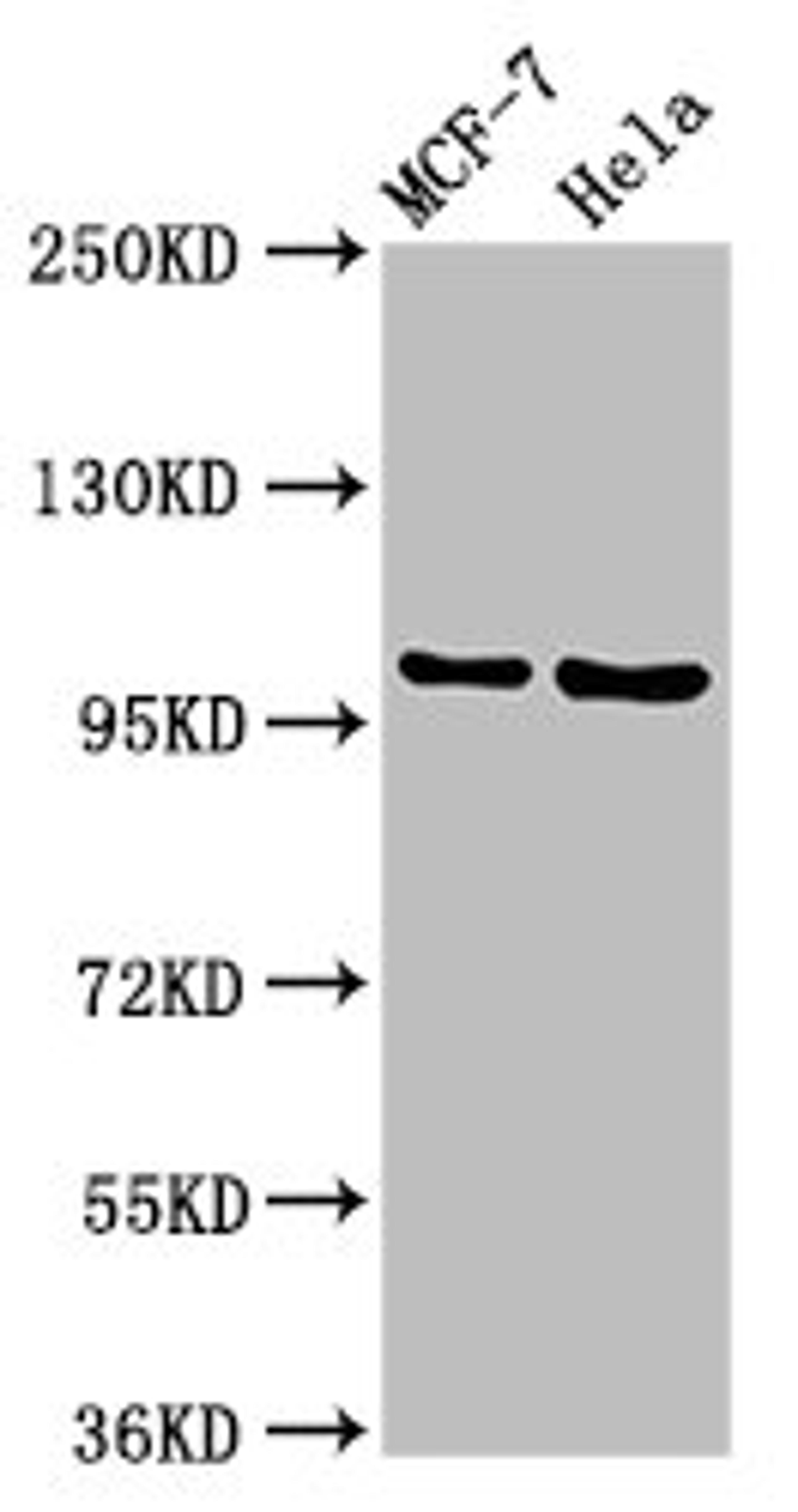 Western Blot. Positive WB detected in: MCF-7 whole cell lysate, Hela whole cell lysate. All lanes: NUP98 antibody at 3.2ug/ml. Secondary. Goat polyclonal to rabbit IgG at 1/50000 dilution. Predicted band size: 198, 188, 98, 97, 196, 187 kDa. Observed band size: 105 kDa. 