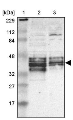 Western Blot: FRA2 Antibody [NBP1-89842] - Lane 1: Marker [kDa] 229, 112, 84, 48, 32, 27, 17<br/>Lane 2: Human cell line RT-4<br/>Lane 3: Human cell line U-251MG sp